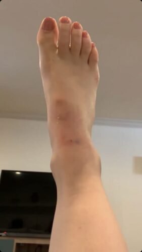 Lucy Hale Feet Toes And Soles 1222