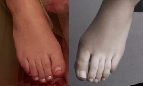 Ashley Olsen Feet Toes And Soles 298